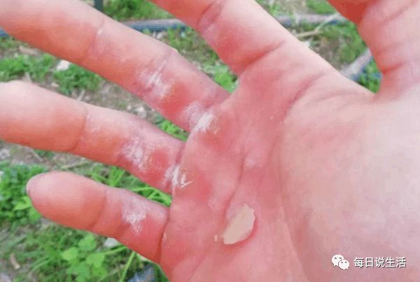 健身用的手套_健身手套有什么用_健身手套有用吗