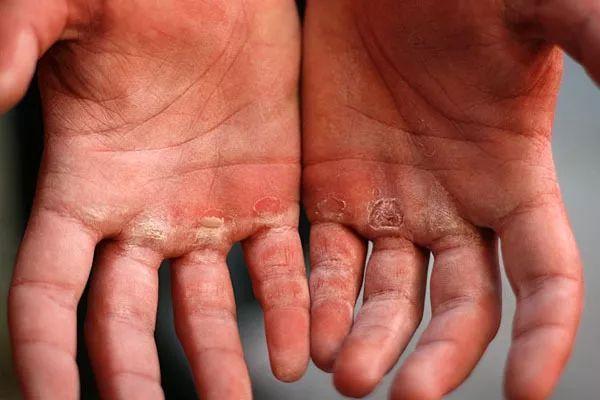 健身要带手套吗_健身手套有必要买带束带的么_手套健身带要洗吗